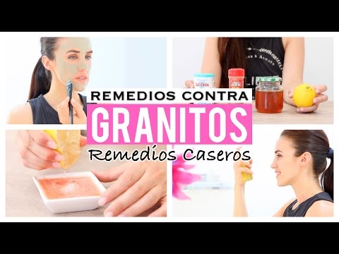 Remedios caseros para quitar los granos de la cara