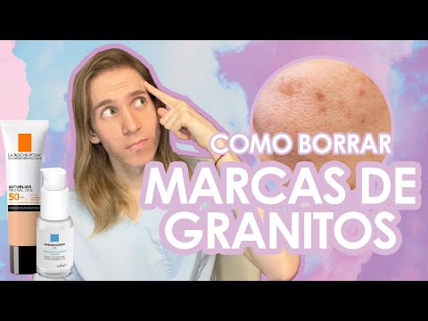 Como quitar las marcas de los granos