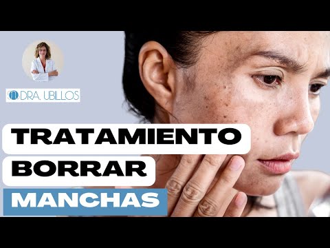 Como quitar las manchas de la cara del sol