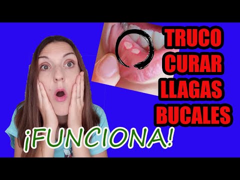 Como curar una llaga en el labio