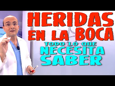 Herida en la boca que no se cura