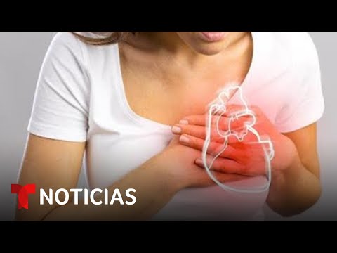 Sintomas de problemas de corazon en mujeres