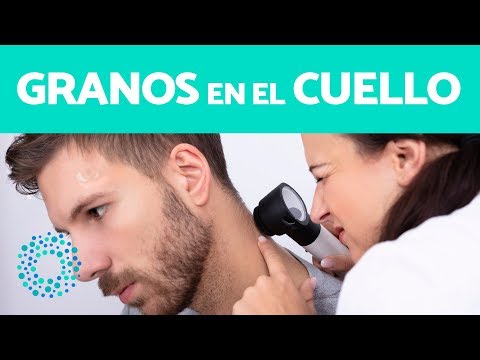 Tipos de granos en el cuello