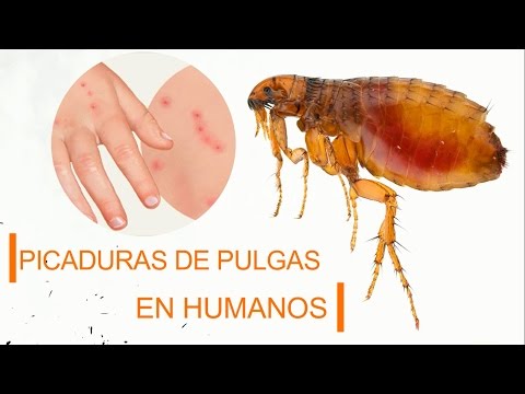 Fotos picaduras de pulgas en humanos