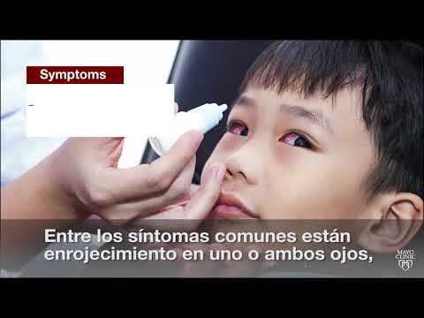 Diferencia entre conjuntivitis y mocos en los ojos ninos