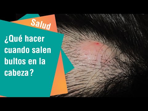 Ansiedad eructos y dolor de pecho