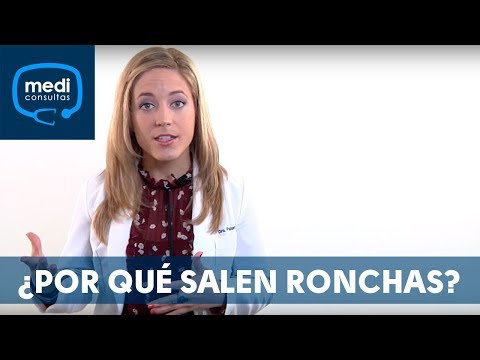 Ronchas en la piel que aparecen y desaparecen