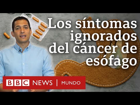 Eructar mucho es sintoma de cancer