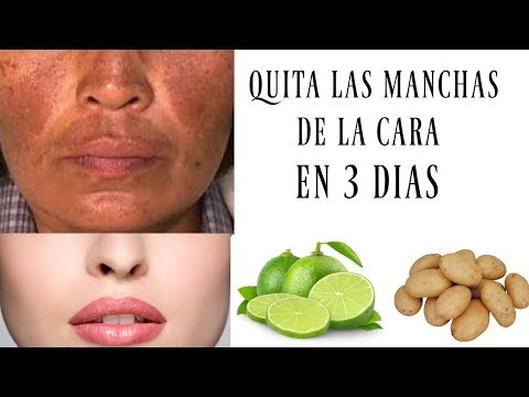 Como quitar las manchas dela cara en una noche