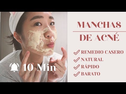 Quitar manchas de acne en un dia