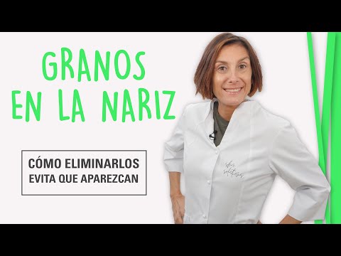 Tipos de granos en la nariz