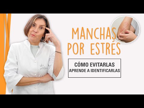 Manchas en la piel por estres