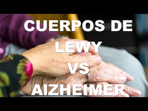 Diferencia entre demencia por cuerpos de lewy y alzheimer