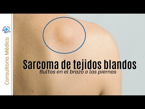 Bulto en la pierna sin dolor