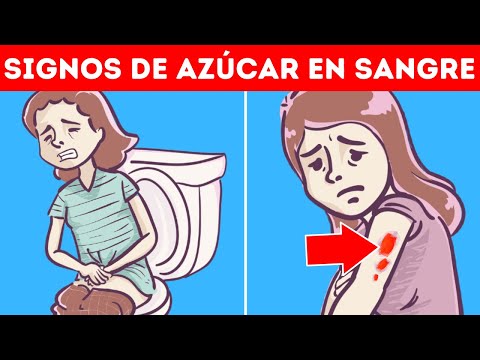 Niveles de azucar en sangre peligrosos