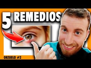 Salud psicología - Todo sobre salud y psicología 3 Que es bueno para un orzuelo