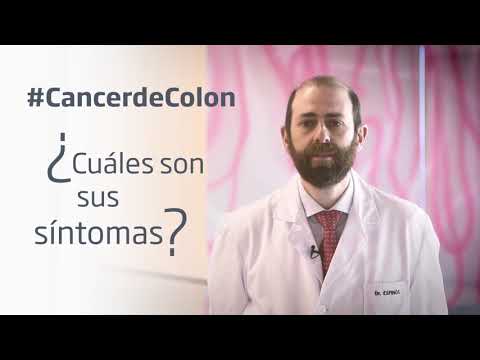 Alerta 6 sintomas del cancer de colon