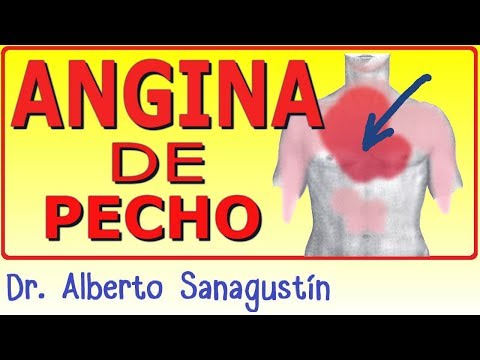 Un electrocardiograma detecta una angina de pecho