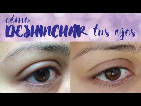 Como deshinchar los ojos en 5 minutos