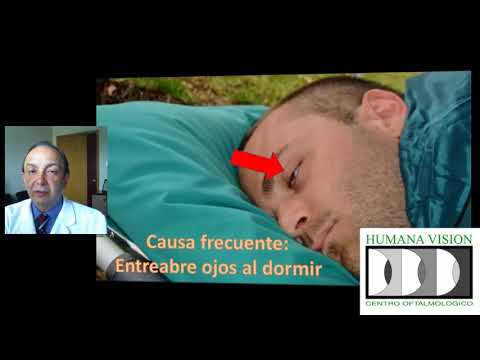 Como dormir con los ojos abiertos