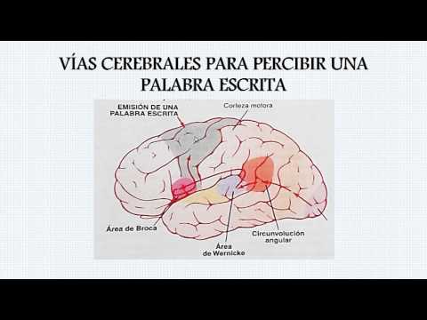 Afasia de broca y de wernicke