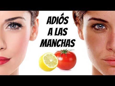 Manchas en la cara por el sol remedios caseros