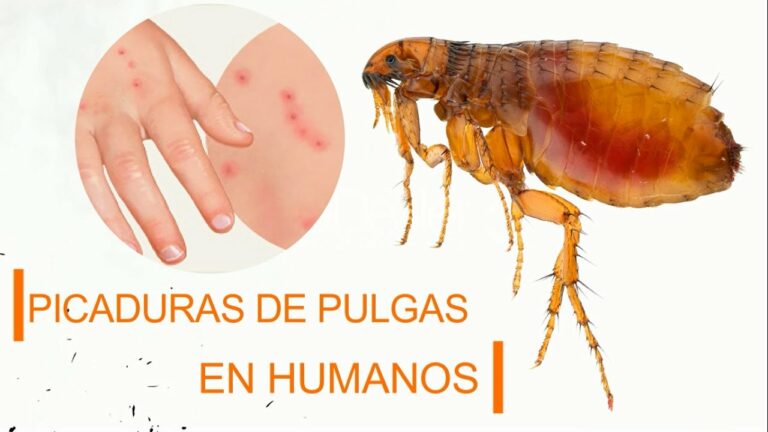 Fotos picaduras de pulgas en humanos